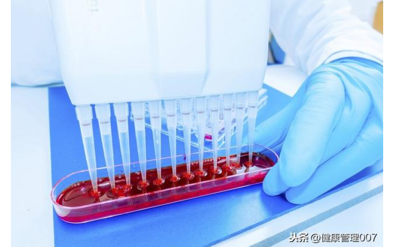 上?？諝鈾z測項(xiàng)目清單及費(fèi)用